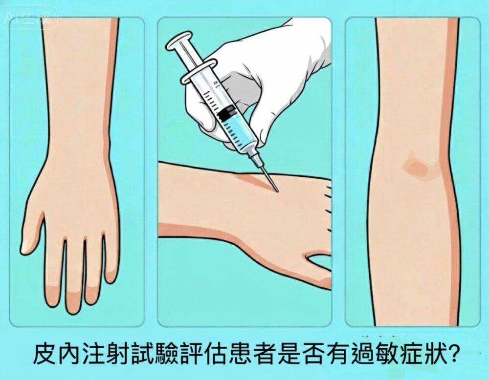 皮膚試驗詳解:塵蟎過敏診斷的金標準